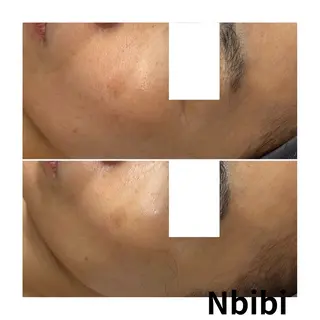韓国🇰🇷価格 サロン_Nbibiの眉毛・アイブロウイメージ