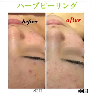 脱毛&シェービング 専門店LUANAのエステ・リラクイメージ