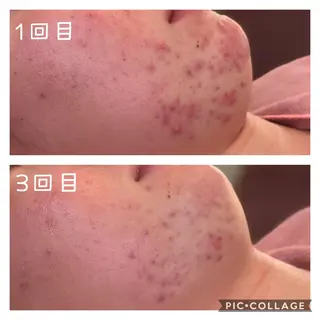 美肌蘇生カウンセラー 横山りえのエステ・リラクイメージ