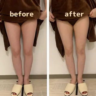 リンパマッサージ mimozaのエステ・リラクイメージ