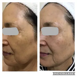 プライベートサロン LaLa 北山まいこのエステ・リラクイメージ