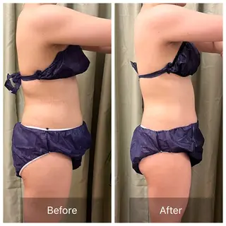 【元に戻らない】 小顔&部分痩せのその他イメージ