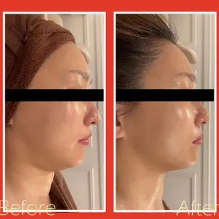 立体小顔×艶肌×美ボ ディ似合わせ施術 岡のエステ・リラクイメージ