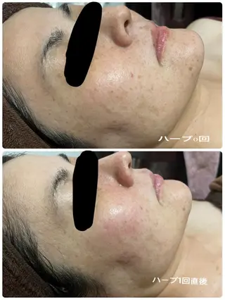 SALON BioBioのエステ・リラクイメージ