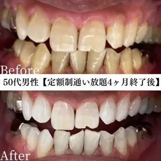 キッズ メンズ セルフホワイトニング WHITE福岡天神店のエステ・リラクイメージ