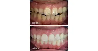 ホワイトニングサロン ラウレアのその他イメージ