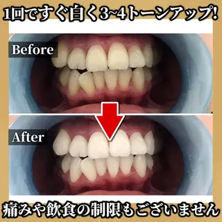 脱毛 TOWA大宮のエステ・リラクイメージ