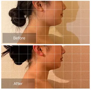 表情筋フェイシャル 三軒茶屋のエステ・リラクイメージ