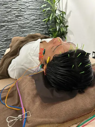 小顔矯/美容鍼/鍼灸 BeauJuのその他イメージ