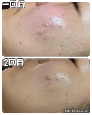 ネイル Feel ‪‪☺︎‬Yuriaのネイルデザイン