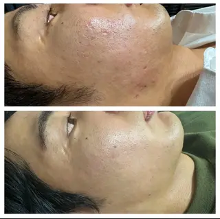 メンズ 医療提携サロン新宿 La Lunaのエステ・リラクイメージ