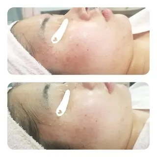 自然派フェイシャル やながわのエステ・リラクイメージ