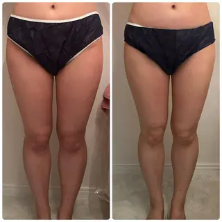 FLEUR 2号店のエステ・リラクイメージ