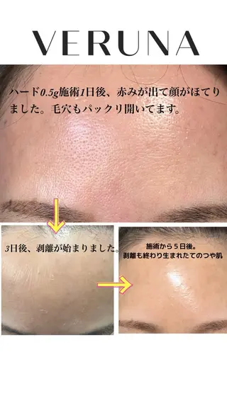 毛穴改善サロン d'Alba大阪住吉のエステ・リラクイメージ