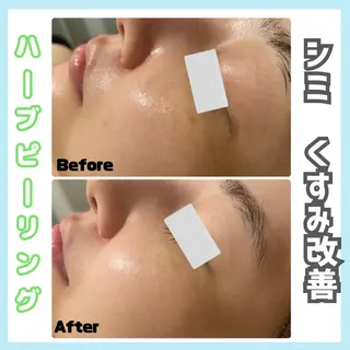 オールハンド専門🤍 痩身/小顔/ ハーブのエステ・リラクイメージ