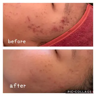 美肌蘇生カウンセラー 横山りえのエステ・リラクイメージ