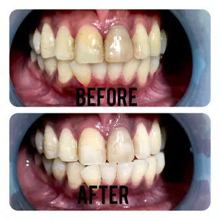 two nailのネイルデザイン