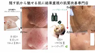 LUMINA ESTHのエステ・リラクイメージ