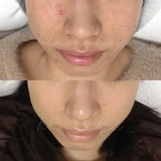 ショート カラー パーマ ヘアアレンジ ネイル マツエク・マツパ アイブロウ 都度払い肌質改善 &脱毛Blancheのエステ・リラクイメージ