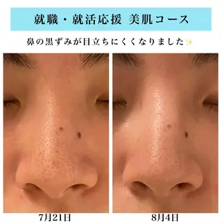 Bellesthe (ベルエステ)のエステ・リラクイメージ