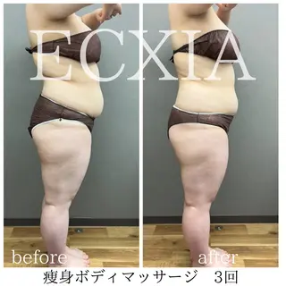 ECXIA 【エクシア】のエステ・リラクイメージ