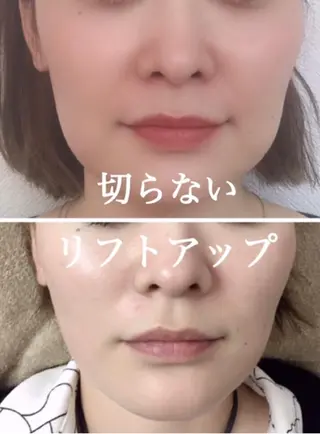 肌質改善サロン chouchouのエステ・リラクイメージ