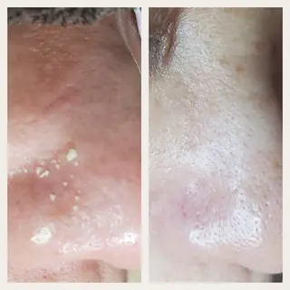 毛穴専門店 マカナアロハのエステ・リラクイメージ