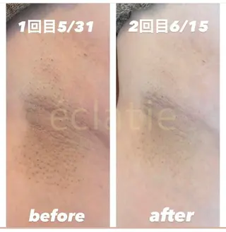 eclatie(エクラティエ)所属・横井 愛奈のエステ・リラクイメージ