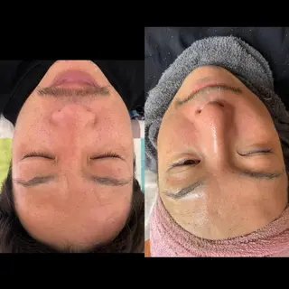 beauty lanaのエステ・リラクイメージ