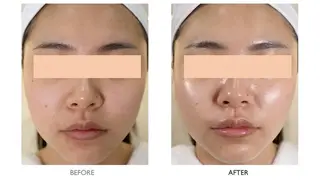 🎀韓国肌管理🎀 Mikiのエステ・リラクイメージ