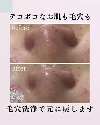肌質改善サロン facialmoonのエステ・リラクイメージ