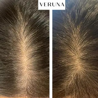 ハーブピーリング専門 葵/LUNEAのエステ・リラクイメージ