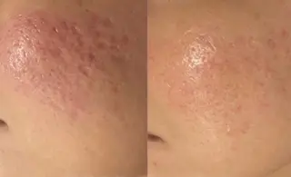 【BUB立川】 ななのエステ・リラクイメージ