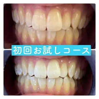ホワイトニングルーム 横浜店のその他イメージ