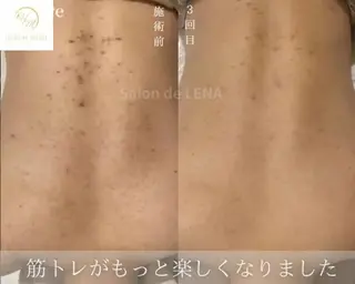 Grandir所属・ハーブピーリング専門 グランディール　武内のエステ・リラクイメージ