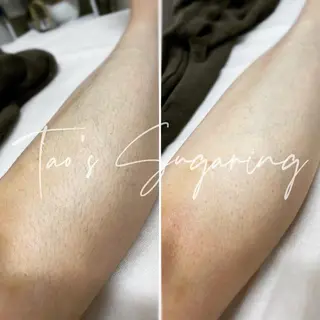 Sugaring / HILOT TAOのエステ・リラクイメージ
