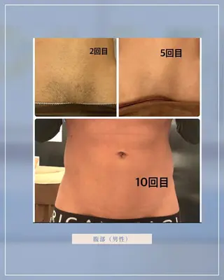 Chavi（チャヴィ）所属・脱毛サロンChavi 東府中店のエステ・リラクイメージ