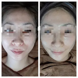 マツエク・マツパ eyelash e'nのネイルデザイン