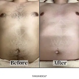 🌙眠れるWAX脱毛 無料モデル募集‼️のエステ・リラクイメージ