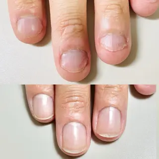 ネイル 自爪育成/深爪矯正salon fam_【ネイルケア・エステ脱毛】所属・自爪育成/深爪矯正 salon fam_のネイルデザイン