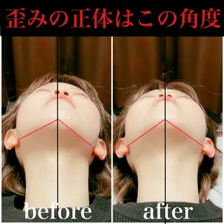 🌈歪み専門🌈 バリンタイ すぎうらのエステ・リラクイメージ