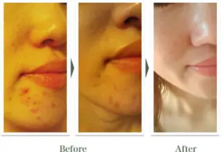 private salon arのマツエク・マツパデザイン