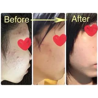 キッズ 福澤 奈摘のエステ・リラクイメージ