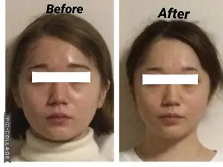 小顔矯正Sho  FaceDesignのエステ・リラクイメージ