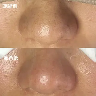 IRO KANAのマツエク・マツパデザイン