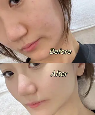 愛維美水光美肌専門店所属・愛維美水光美肌専門店 メンズレディースokのエステ・リラクイメージ