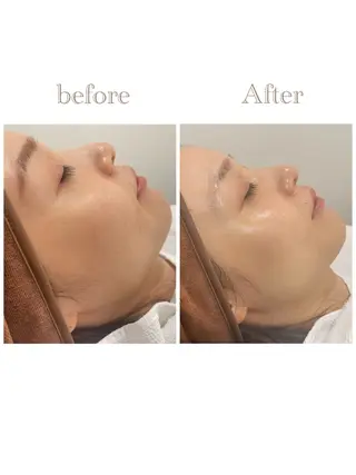 お肌の角質ｹｱ / ﾍﾞﾗｽﾃｷﾞのその他イメージ