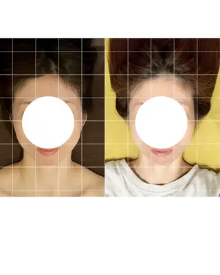 LANI所属・小顔専門サロン MAIのエステ・リラクイメージ