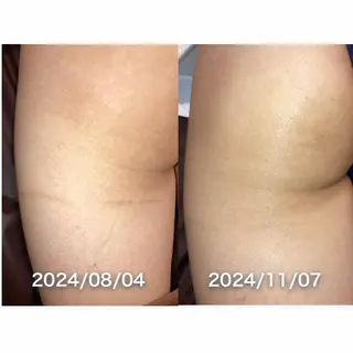 30minutes Rebeautyのエステ・リラクイメージ