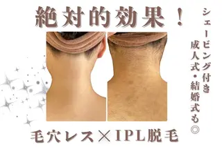 ヘアアレンジ U24限定クーポン レイビス池袋MANAのエステ・リラクイメージ